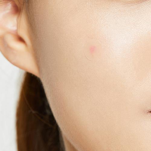 COSRX Acne Pimple Master Patch