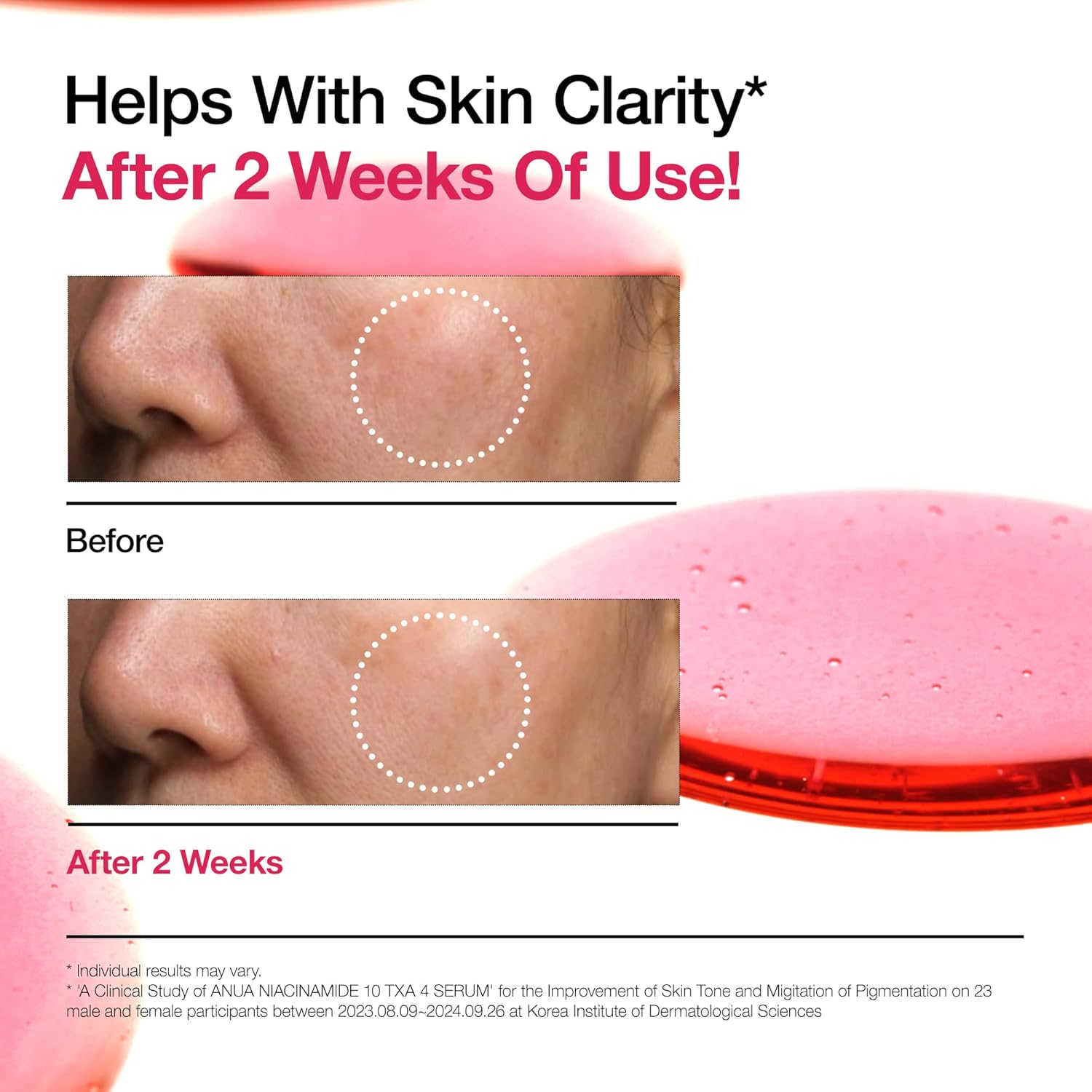 Anua 10% Niacinamide + 4% Tranexamic Acid Serum