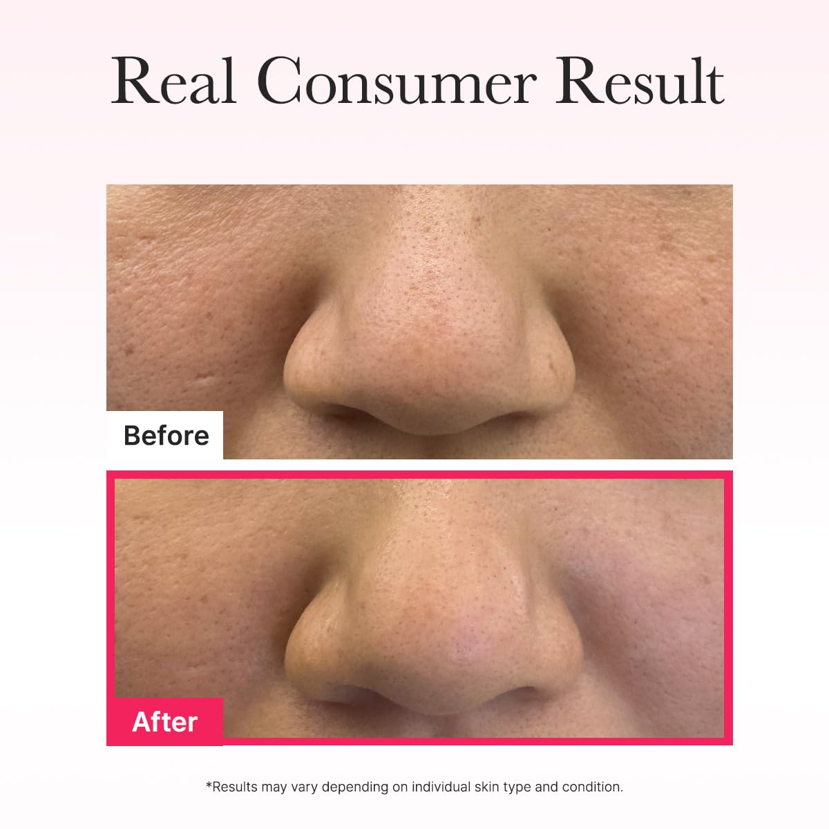 Arencia Red Collagen Jello Mask Box