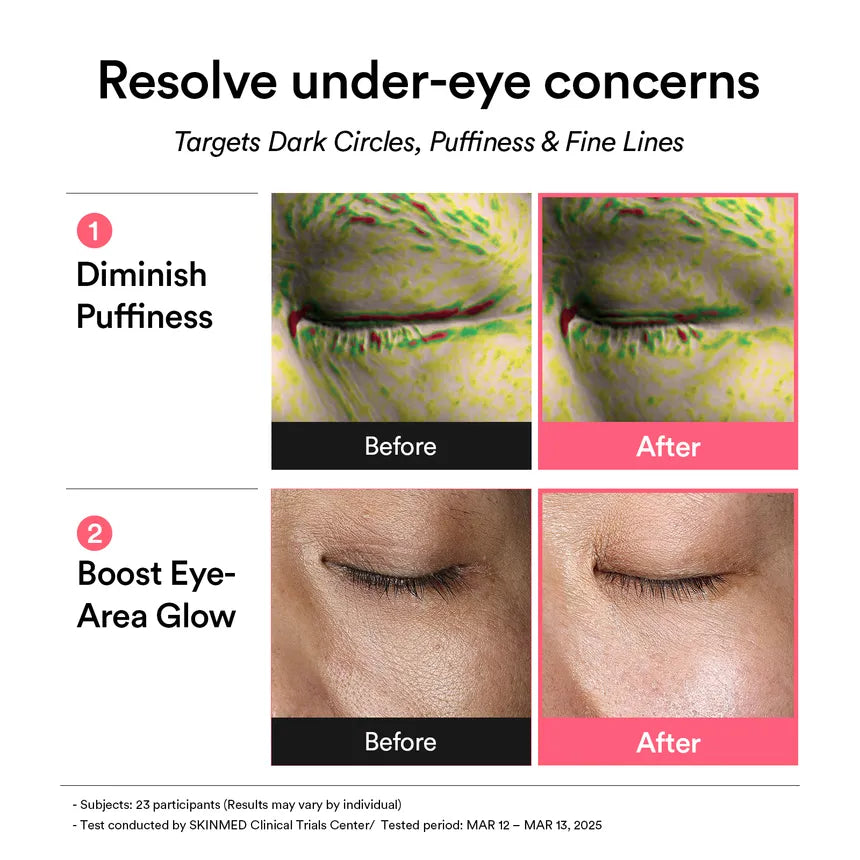 Abib PDRN Retinal Eye Patch Glow Jelly