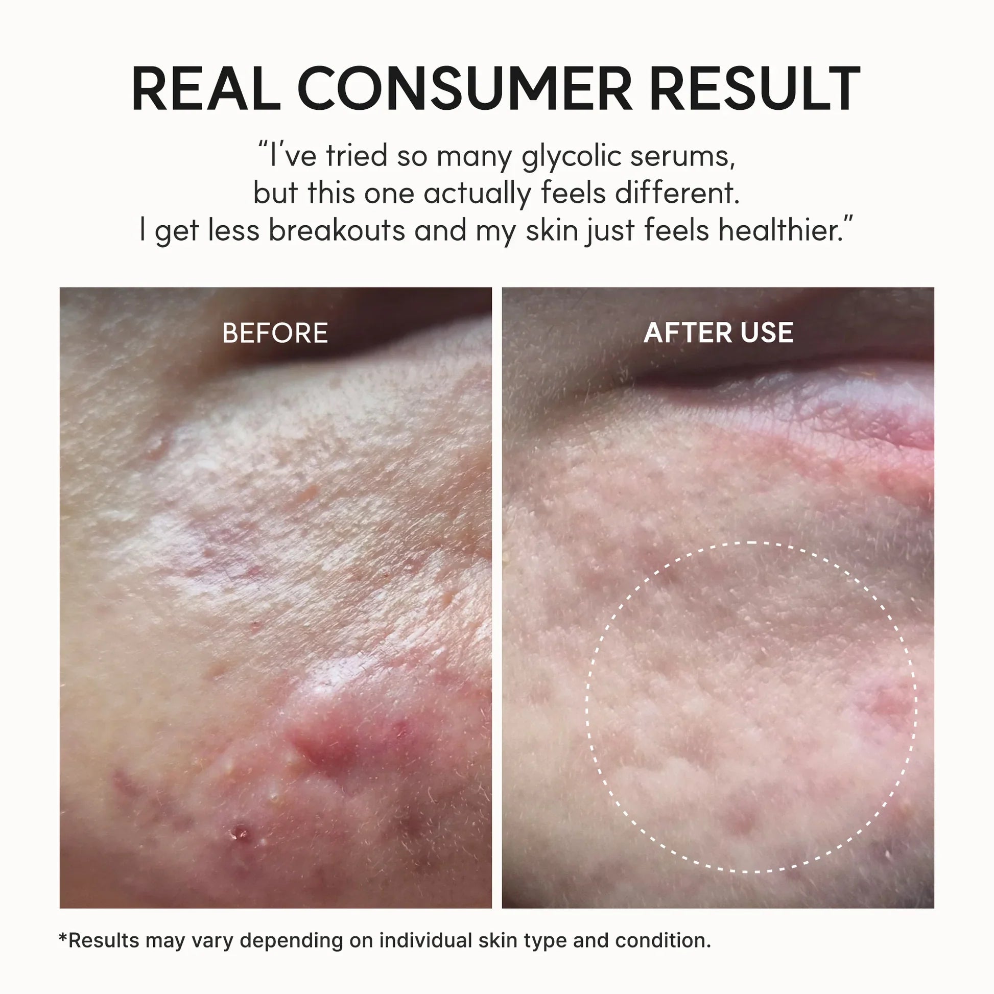 Arencia Eraser Shot Glycolic Acid Booster