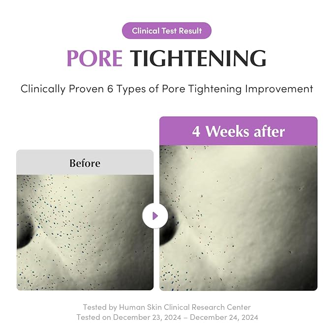 Eqqualberry Purple PDRN Pore Minimizing Serum