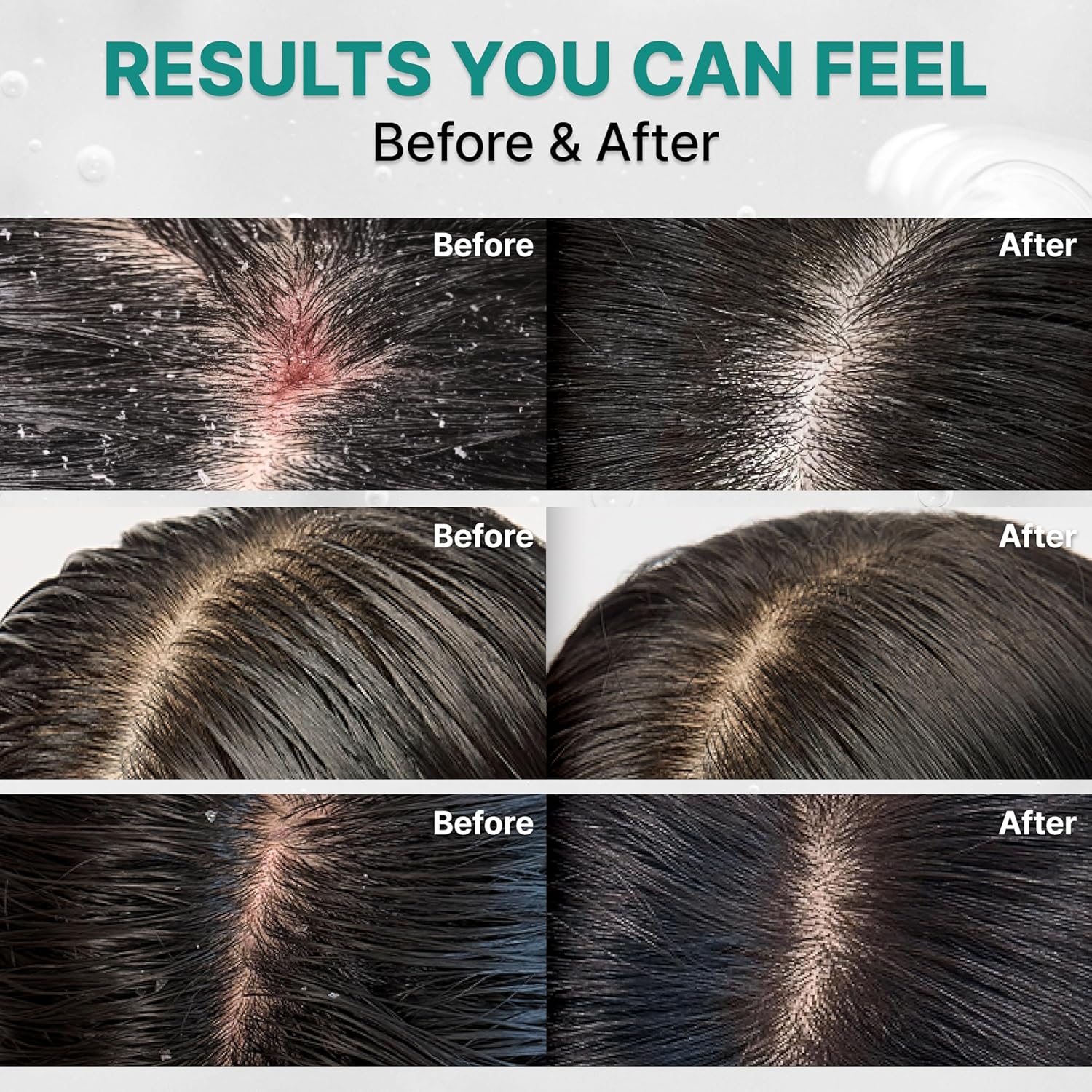 Lilyeve Scalp:Turn Cica PDRN Deep Clean Shampoo 500g