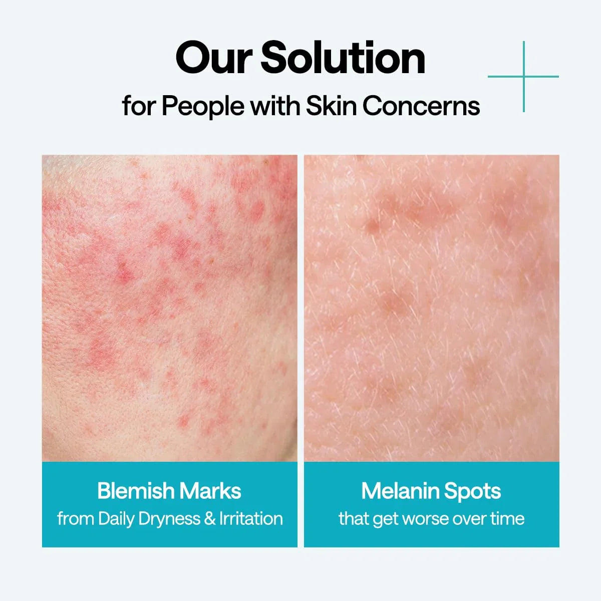 Mediheal Madecassoside Wrapping Serum Mask Blemish Repair