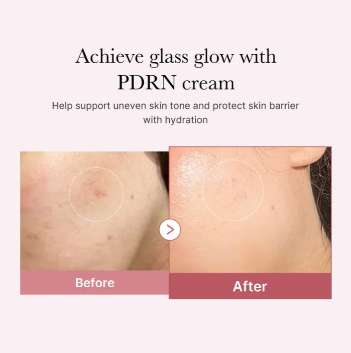 Medicube PDRN Pink Hyaluronic Moisturizing Cream