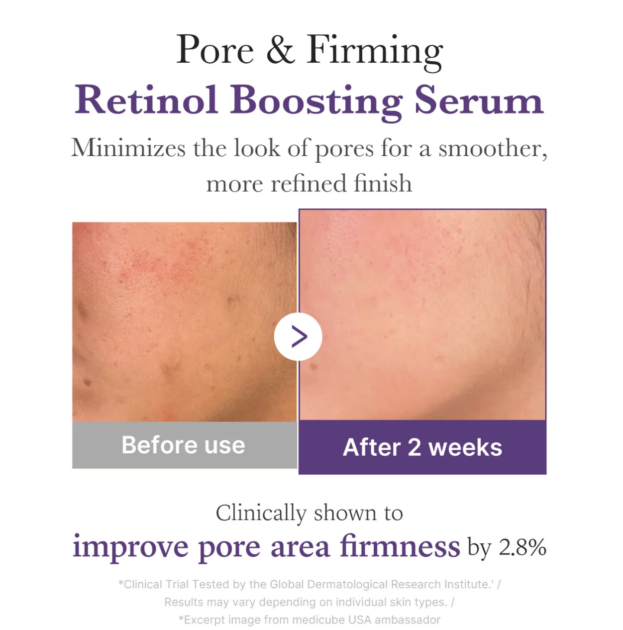 Medicube Retinol NMN Boosting Serum