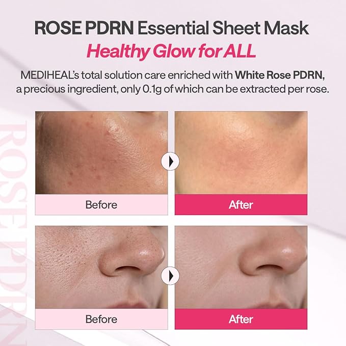 Mediheal Rose PDRN Essential Sheet Mask