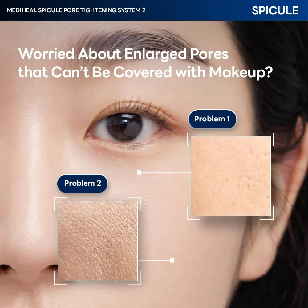 Mediheal Spicule Pore Tightening System 1
