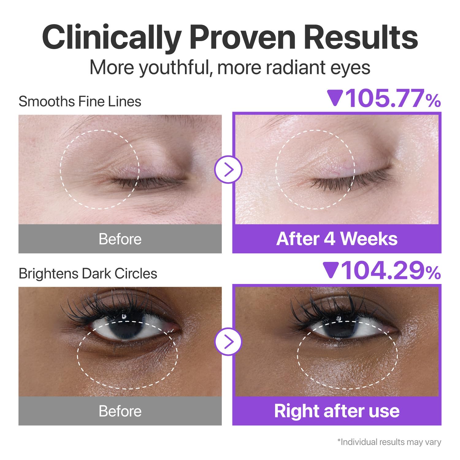 Numbuzin No.9 NAD+ Retinol Eye Cream