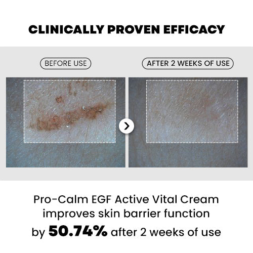 Pro-Calm EGF Active Vital Cream
