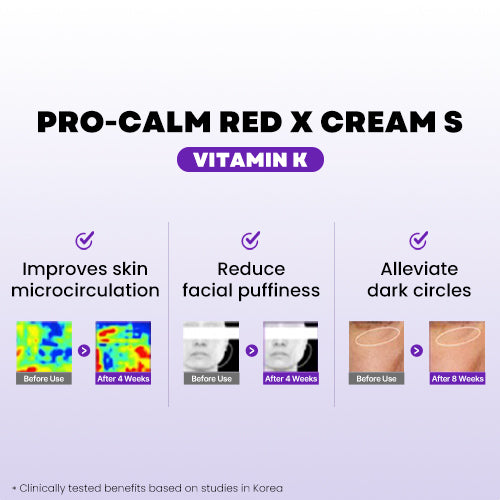 Pro-Calm Red X Cream (Vitamin K Cream)
