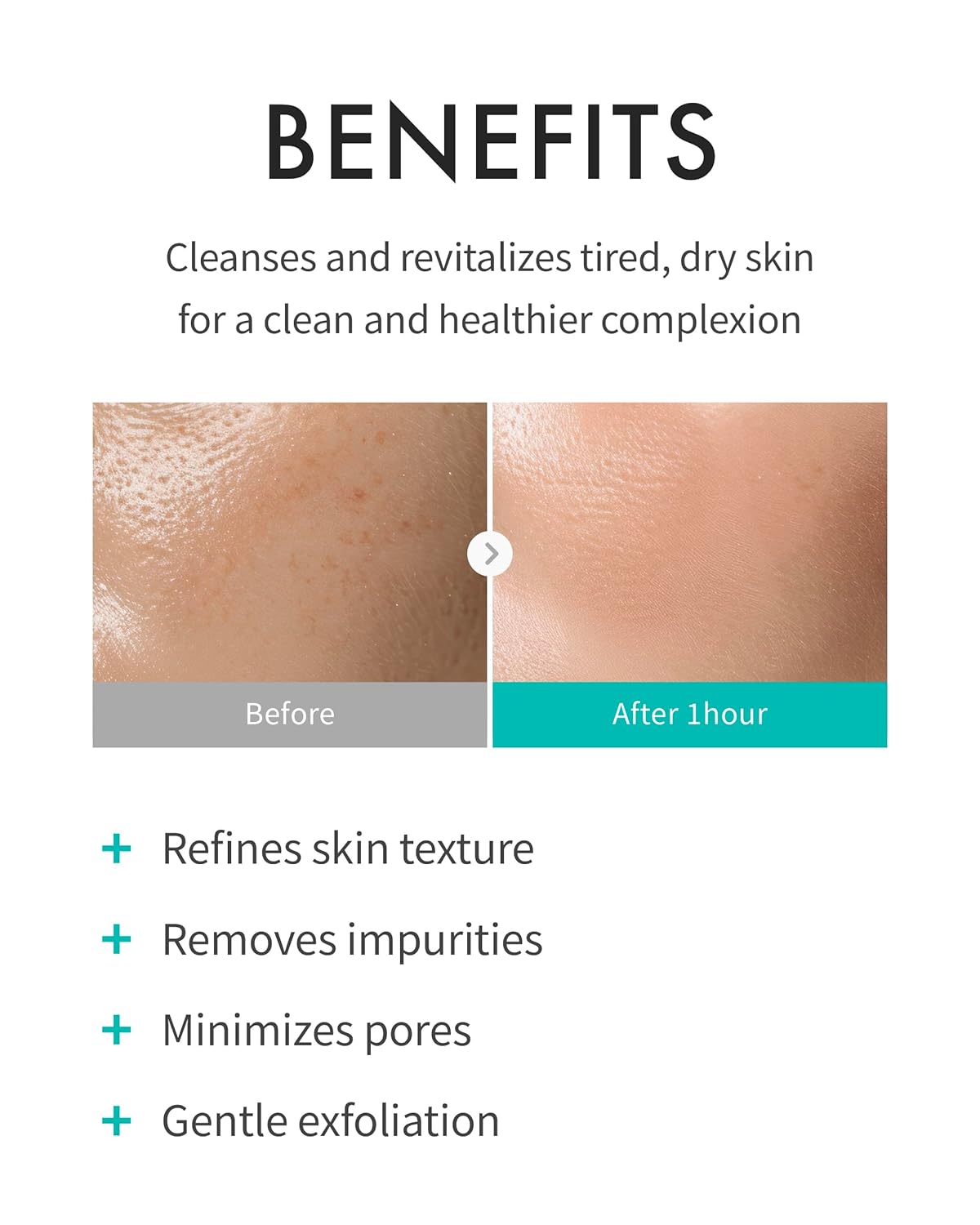 Rejuran Refining Foam Cleanser 120 ml