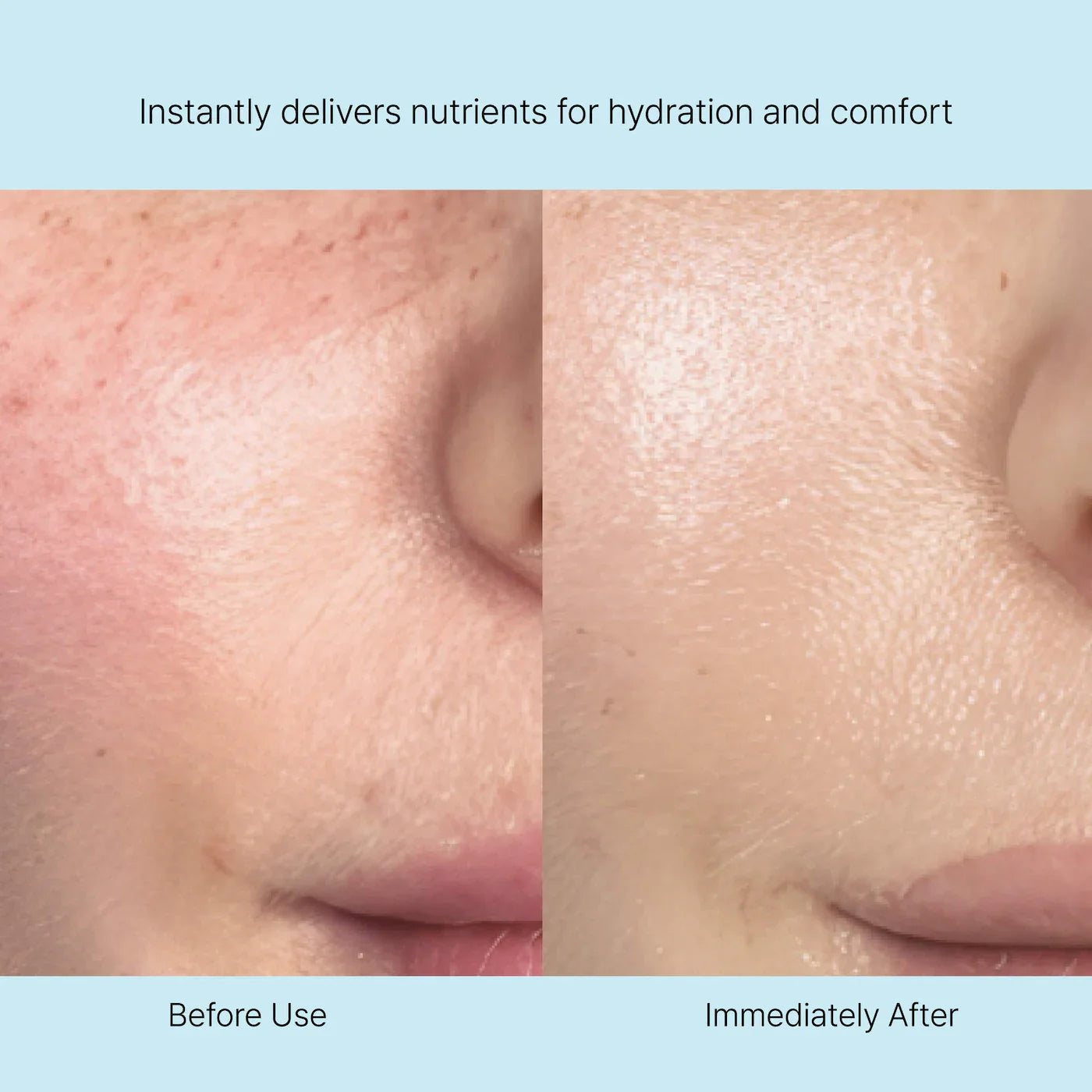 Rejuran Nutritive Cream