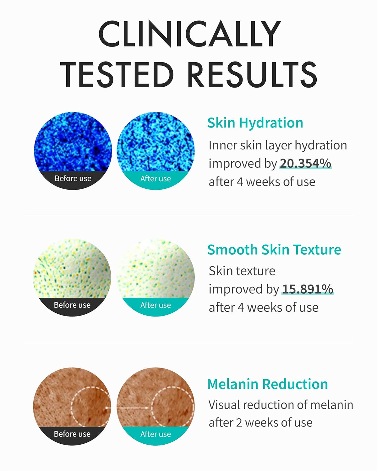 Rejuran Turnover Cream Enhanced (1.69 fl oz)