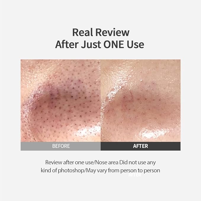 Sungboon Editor Blackhead Melting Clear Pad