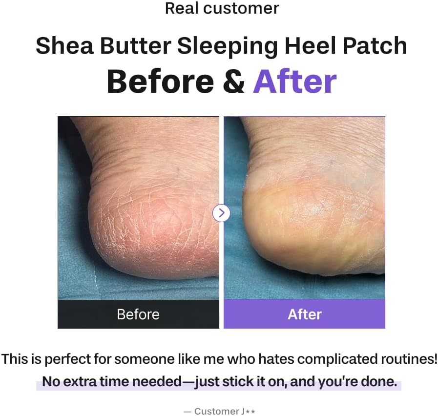 baren Shea Butter Sleeping Heel Patch 2P