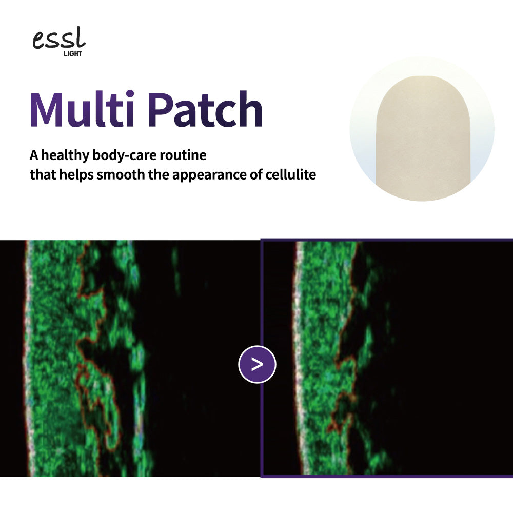 essl Multi Patch (10ea)