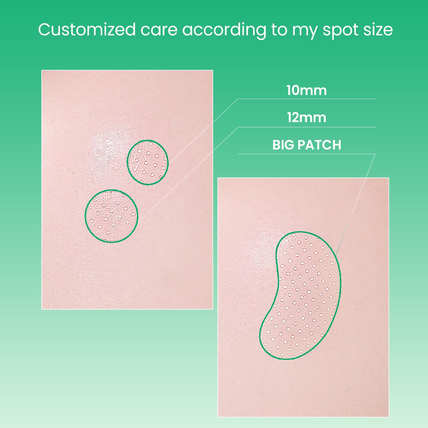 ILSO No Problem Spot Patch